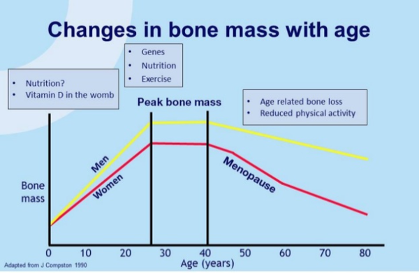 Age changing. Osteoporosis physical activity. Reduced physical activity. Physical strength rate. Peak Bone.
